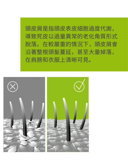 Mediket Plus 100mL - 醫學專效抗屑去癢洗髮露 | 專效對抗嚴重頭皮屑及頭皮紅癢