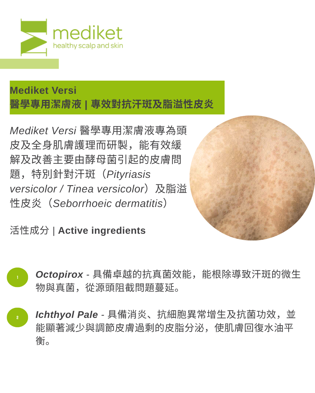 Mediket Versi 120mL - 醫學專用潔膚液 | 專效對抗汗斑及脂溢性皮炎